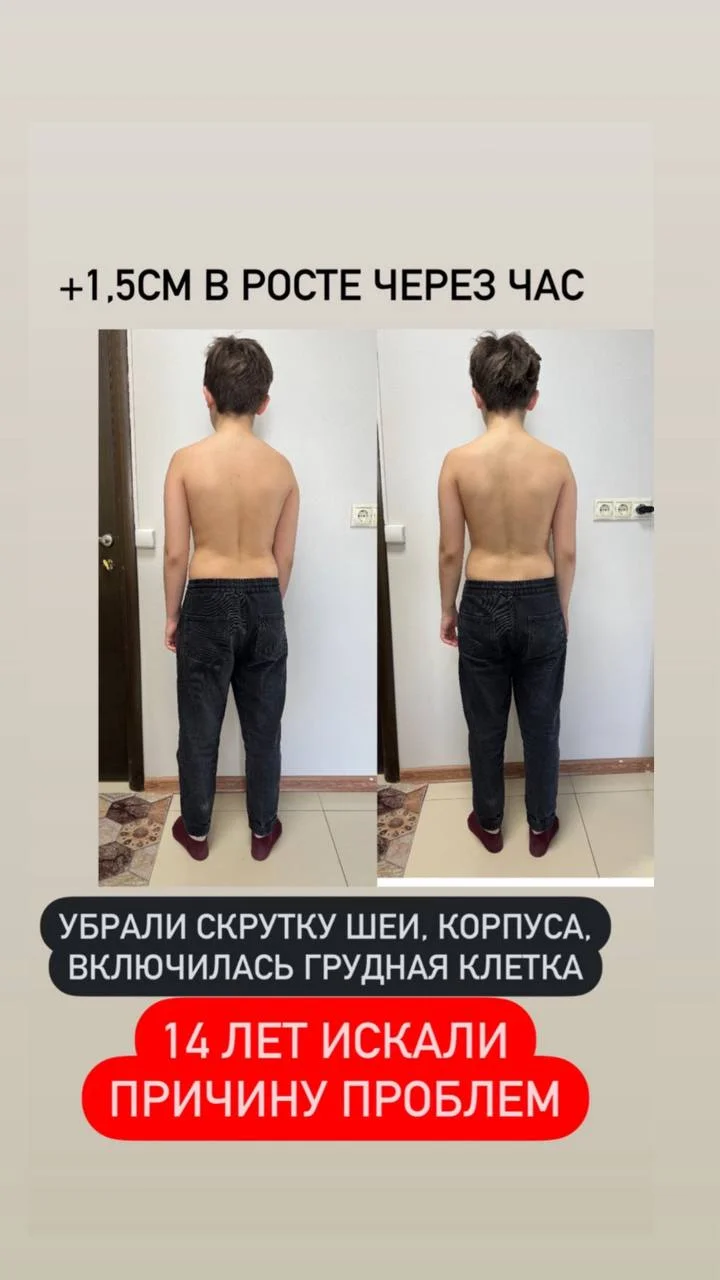 Исправление осанки взрослым и детям