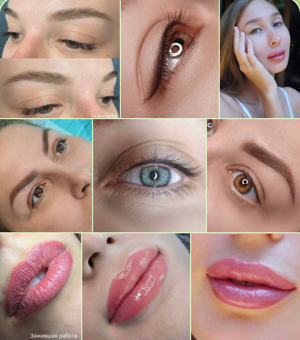 Изображение 1