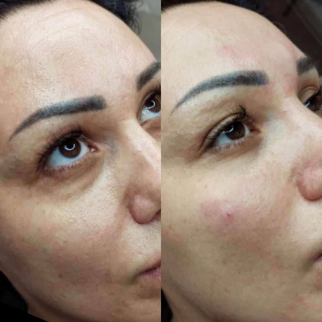 Esthetic Pro Нячанг